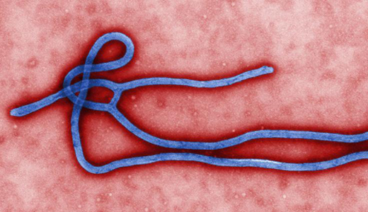 警惕最新病毒病人，你需要了解這些關(guān)鍵信息！