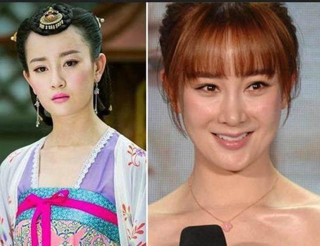 坦然面對(duì)整容，女明星的美麗新篇章之旅