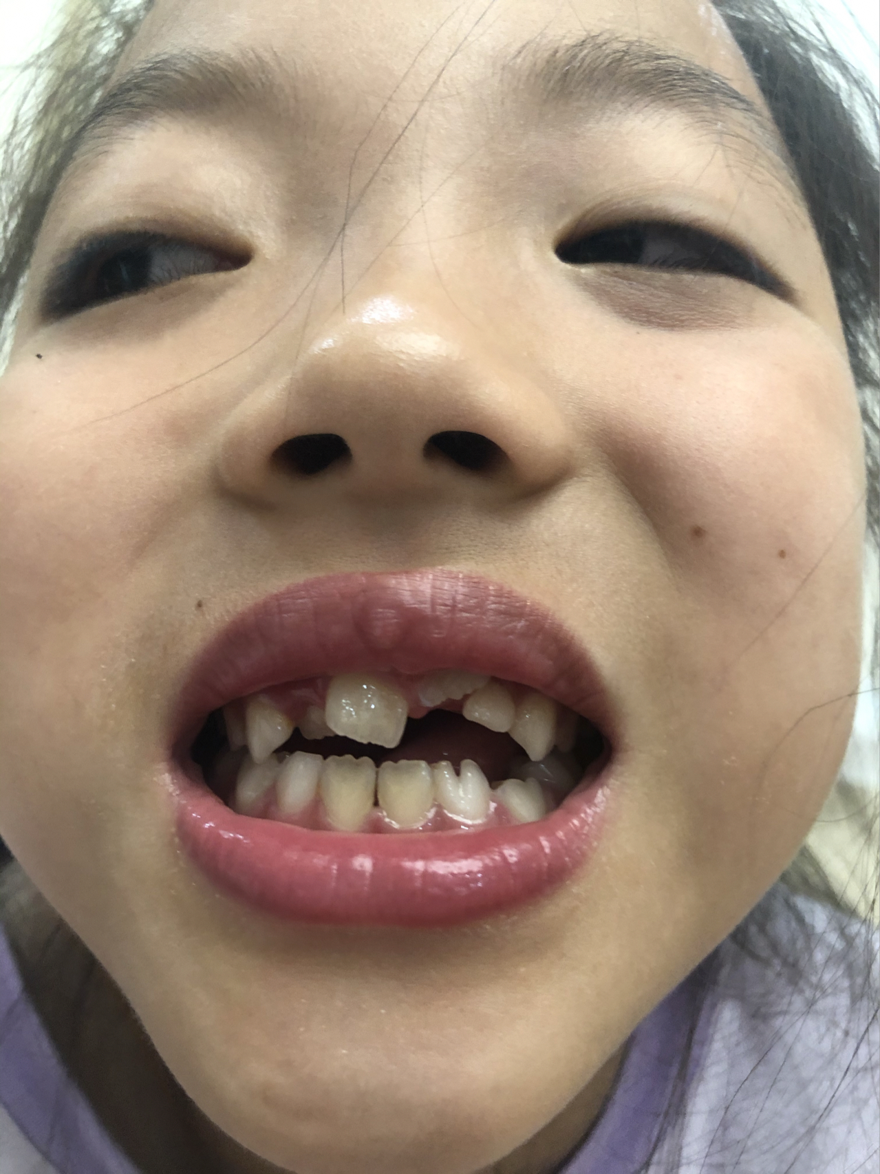 莊最新牙齒技術(shù)揭秘，牙齒美容新選擇